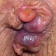 Illustration for article titled obat ambeien wasir